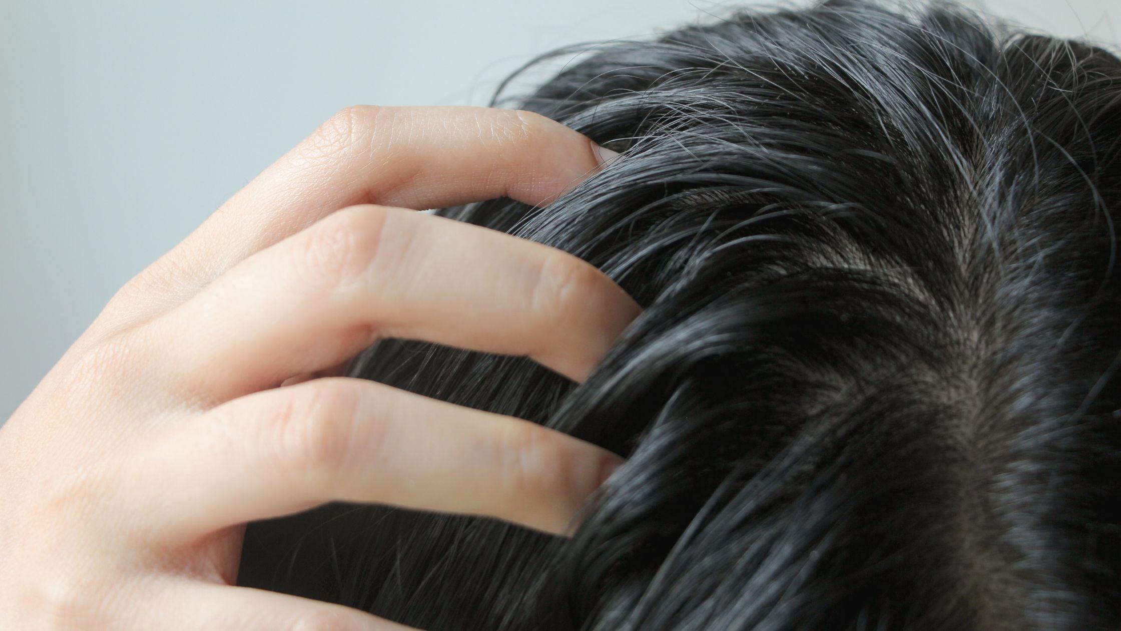 Managing Oily Scalp and Dry Hair Understanding the Causes and Solutio Rthvi
