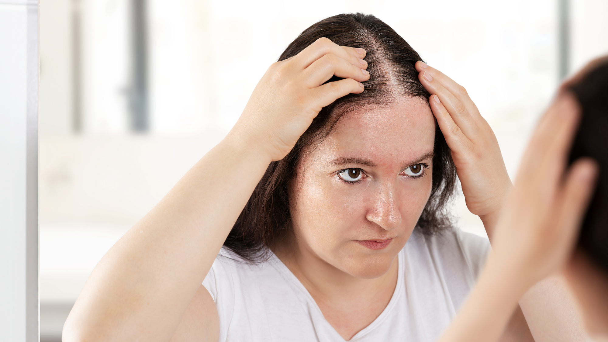 Navigating Hair Thinning During Perimenopause: Causes and Solutions