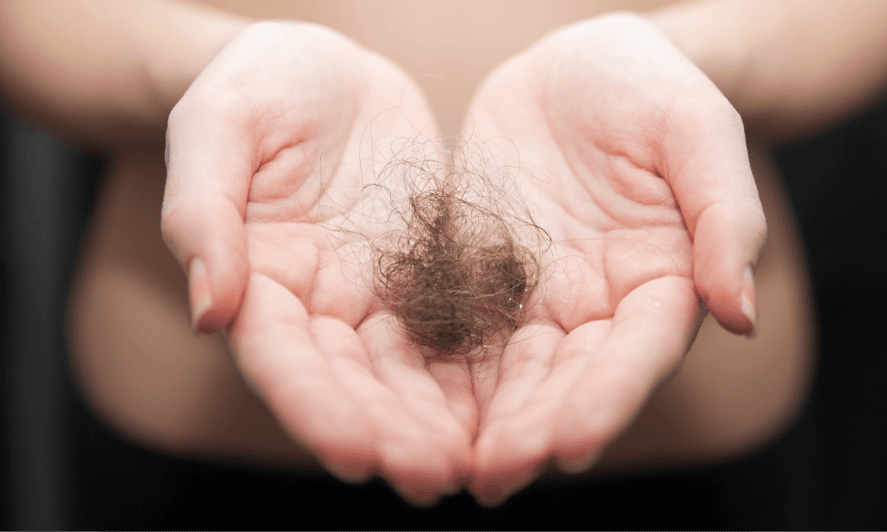 Hair fall and stress: How to manage them together