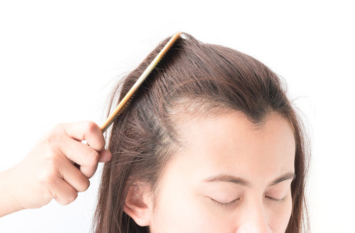 Hair thinning in women and female pattern hair loss