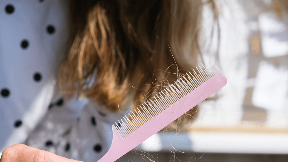 Hair fall in Women: Causes and Treatment options